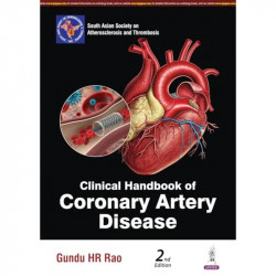 Clinical Handbook of Coronary Artery Disease, 2/E for Cardiologists and DM/DNB Postgraduates | SASAT Monograph on CAD in Sou…