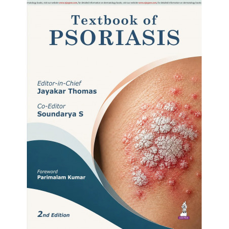 Textbook of Psoriasis, 2/E for Dermatology Postgraduates and Practicing Dermatologists | Clinical, Immunopathological and Th…