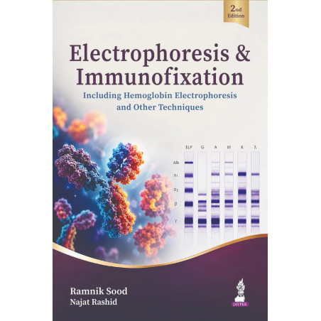 Electrophoresis & Immunofixation, 2/E for Pathologists and PG Pathology Students | Including Hemoglobin Electrophoresis, Ser…