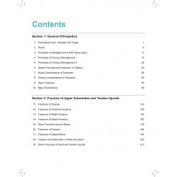 Orthopedics Notes for Undergraduates for MBBS Students | NEET PG, INI-CET and FMGE Exam-Oriented Revision | Fractures, Traum… -