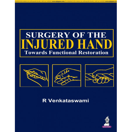 Surgery of the Injured Hand Toward Functional Restoration with 2 Interactive DVD-ROMs book by Venkataswami