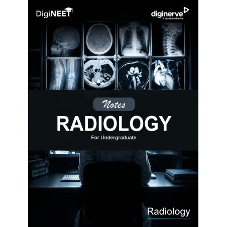 Radiology Notes for Undergraduates for MBBS Students | High-Yield Color-Coded Notes on X-Rays, CT and MRI with PYQs for NEET…