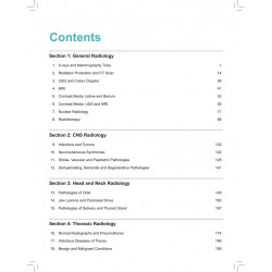 Radiology Notes for Undergraduates for MBBS Students | High-Yield Color-Coded Notes on X-Rays, CT and MRI with PYQs for NEET… -