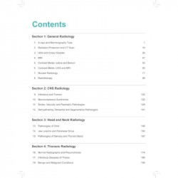 Radiology Notes for Undergraduates for MBBS Students | High-Yield Color-Coded Notes on X-Rays, CT and MRI with PYQs for NEET… -