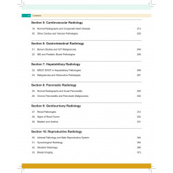 Radiology Notes for Undergraduates for MBBS Students | High-Yield Color-Coded Notes on X-Rays, CT and MRI with PYQs for NEET… -