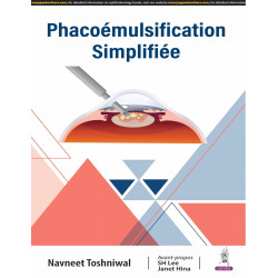 PHACOEMULSIFICATION SIMPLIFIEE (FRENCH EDITION) book by Navneet Toshniwal