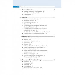 PHACOEMULSIFICATION SIMPLIFIEE (FRENCH EDITION) book by Navneet Toshniwal - Additional Image 8