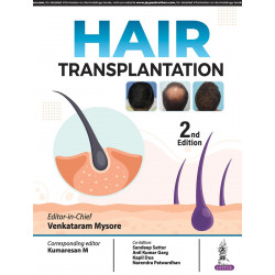 HAIR TRANSPLANTATION book by Venkataram Mysore