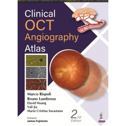 Clinical OCT Angiography Atlas book by Maria Cristina Savastano Marco Rispoli,Bruno Lumbroso,David Huang,Yali Jia