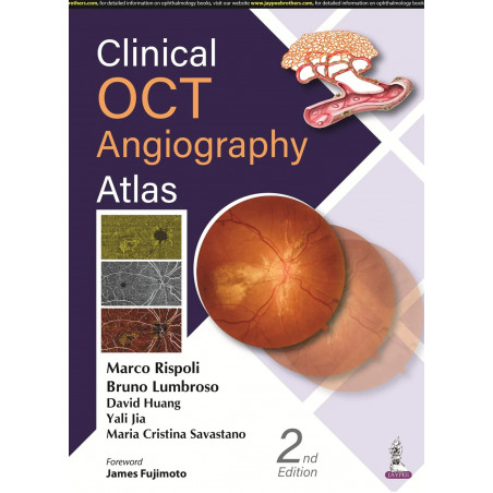 Clinical OCT Angiography Atlas book by Maria Cristina Savastano Marco Rispoli,Bruno Lumbroso,David Huang,Yali Jia