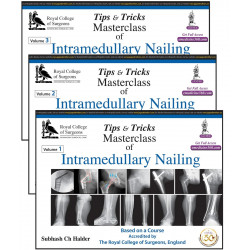 Tips and Tricks Masterclass of Intramedullary Nailing book by Halder Subash