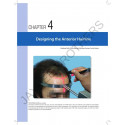 STEP BY STEP HAIR TRANSPLANTATION book by Pradeep Sethi, Arika Bansal - Additional Image 6