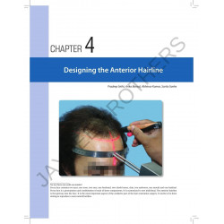 STEP BY STEP HAIR TRANSPLANTATION book by Pradeep Sethi, Arika Bansal - Additional Image 6