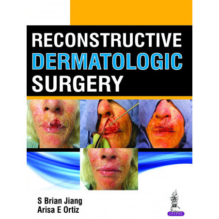 Reconstructive Dermatologic Surgery book by S Brian Jiang, Arisa E Ortiz