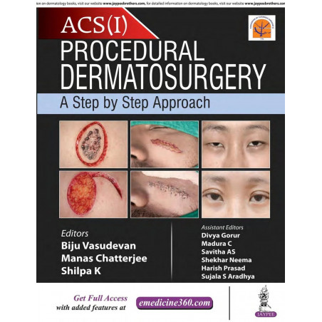 ACS(I) PROCEDURAL DERMATOSURGERY A STEP BY STEP APPROACH book by Biju Vasudevan, Manas Chatterjee