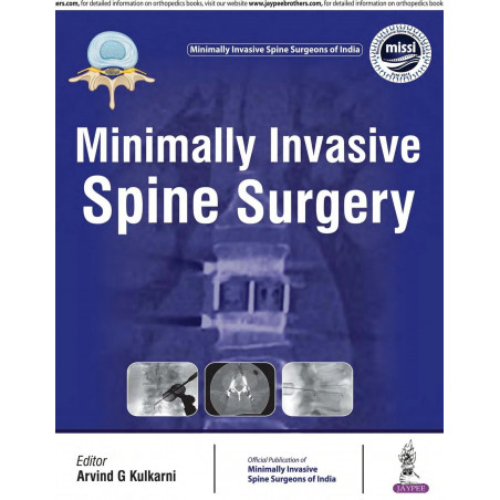 MINIMALLY INVASIVE SPINE SURGERY(OFFICIAL PUBLICATION OF MINIMALLY INVASIVE SPINE SURGEONS OF INDIA) book by Arvind Kulkarni