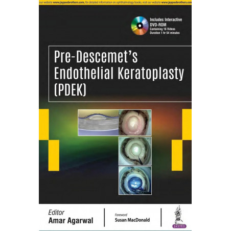 PRE-DESCEMET'S ENDOTHELIAL KERATOPLASTY(PDEK) book by Amar Agarwal