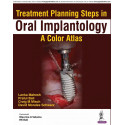TREATMENT PLANNING STEPS IN ORAL IMPLANTOLOGY:A COLOR ATLAS book by Lanka Mahesh, Praful Bali