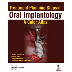 TREATMENT PLANNING STEPS IN ORAL IMPLANTOLOGY:A COLOR ATLAS book by Lanka Mahesh, Praful Bali