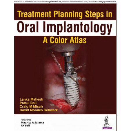 TREATMENT PLANNING STEPS IN ORAL IMPLANTOLOGY:A COLOR ATLAS book by Lanka Mahesh, Praful Bali