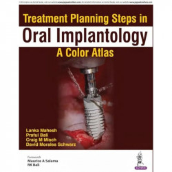 TREATMENT PLANNING STEPS IN ORAL IMPLANTOLOGY:A COLOR ATLAS book by Lanka Mahesh, Praful Bali - Back Cover