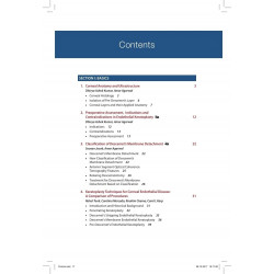 PRE-DESCEMET'S ENDOTHELIAL KERATOPLASTY(PDEK) book by Amar Agarwal - Additional Image 5