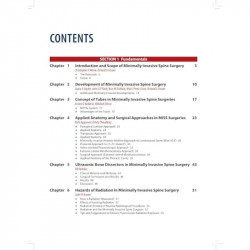 MINIMALLY INVASIVE SPINE SURGERY(OFFICIAL PUBLICATION OF MINIMALLY INVASIVE SPINE SURGEONS OF INDIA) book by Arvind Kulkarni - A