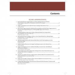 TREATMENT PLANNING STEPS IN ORAL IMPLANTOLOGY:A COLOR ATLAS book by Lanka Mahesh, Praful Bali - Additional Image 6