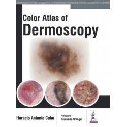 COLOR ATLAS OF DERMOSCOPY book by Horacio Cabo