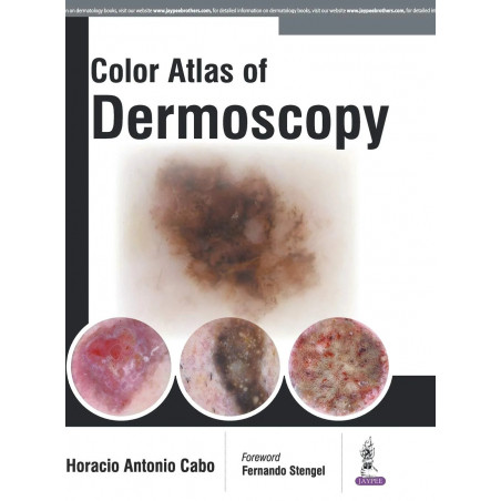 COLOR ATLAS OF DERMOSCOPY book by Horacio Cabo