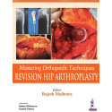 MASTERING ORTHOPEDIC TECHNIQUES REVISION HIP ARTHROPLASTY book by Malhotra Rajesh