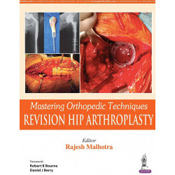 MASTERING ORTHOPEDIC TECHNIQUES REVISION HIP ARTHROPLASTY book by Malhotra Rajesh