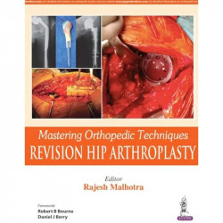MASTERING ORTHOPEDIC TECHNIQUES REVISION HIP ARTHROPLASTY book by Malhotra Rajesh - Back Cover