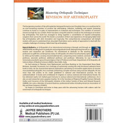 MASTERING ORTHOPEDIC TECHNIQUES REVISION HIP ARTHROPLASTY book by Malhotra Rajesh - Additional Image 3