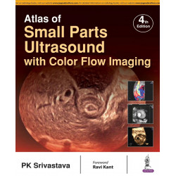 ATLAS OF SMALL PARTS ULTRASOUND WITH COLOR FLOW IMAGING book by PK Srivastava