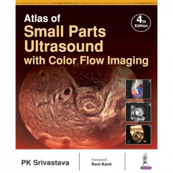 ATLAS OF SMALL PARTS ULTRASOUND WITH COLOR FLOW IMAGING book by PK Srivastava - Back Cover