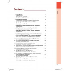 MASTERING ORTHOPEDIC TECHNIQUES REVISION HIP ARTHROPLASTY book by Malhotra Rajesh - Additional Image 5