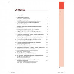 MASTERING ORTHOPEDIC TECHNIQUES REVISION HIP ARTHROPLASTY book by Malhotra Rajesh - Additional Image 6
