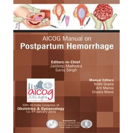 AICOG MANUAL ON POSTPARTUM HEMORRHAGE book by Malhotra Jaideep