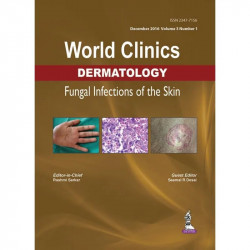 WORLD CLINICS DERMATOLOGY FUNGAL INFECTIONS OF THE SKIN (DEC.2016,VOL.3,NO.1) book by Rashmi Sarkar