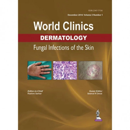 WORLD CLINICS DERMATOLOGY FUNGAL INFECTIONS OF THE SKIN (DEC.2016,VOL.3,NO.1) book by Rashmi Sarkar