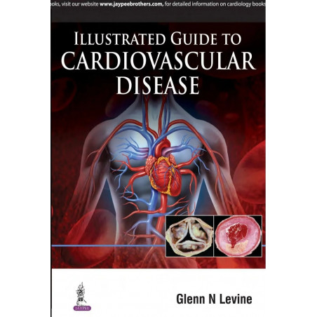 ILLUSTRATED GUIDE TO CARDIOVASCULAR DISEASE book by Levine Glenn. N