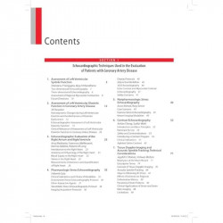 APPLIED ECHOCARDIOGRAPHY IN CORONARY ARTERY DISEASE INCLUDES CD-ROM book by Kasliwal Ravi R - Additional Image 6