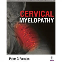 Cervical Myelopathy book by Passias Peter G - Back Cover