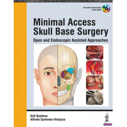 MINIMAL ACCESS SKULL BASE SURGERY OPEN AND ENDOSCOPIC ASSISTED APPROACHES WITH DVD-ROM book by Boahene Kofi