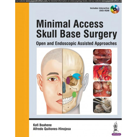 MINIMAL ACCESS SKULL BASE SURGERY OPEN AND ENDOSCOPIC ASSISTED APPROACHES WITH DVD-ROM book by Boahene Kofi