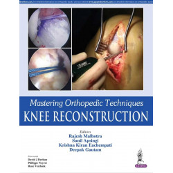 MASTERING ORTHOPEDIC TECHNIQUES KNEE RECONSTRUCTION book by Malhotra Rajesh