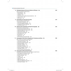 Musculoskeletal Ultrasound book by Holsbeeck Marnix T Van - Additional Image 7