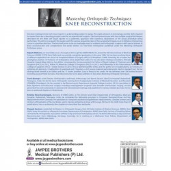 MASTERING ORTHOPEDIC TECHNIQUES KNEE RECONSTRUCTION book by Malhotra Rajesh - Additional Image 4