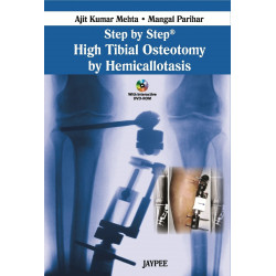 STEP BY STEP HIGH TIBIAL OSTEOTOMY BY HEMICALLOTASIS WITH DVD ROM book by Mehta